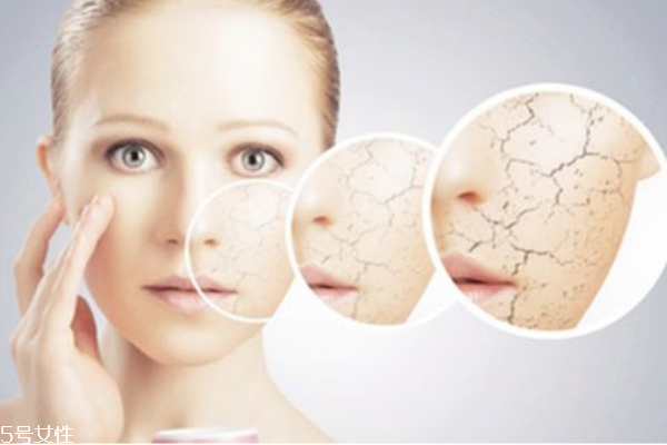 脸部干燥起皮怎么办才能有效啊,脸部干燥起皮怎么办用什么护肤品 脸部干燥起皮怎么办才能有效啊,脸部干燥起皮怎么办用什么护肤品