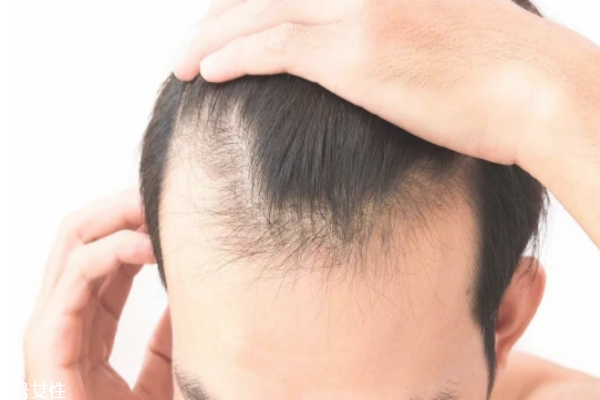 有硅油的洗发水对人体有害吗,无硅油洗发水对人体的危害