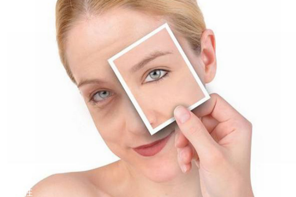 果酸身体乳可以涂脸上吗,果酸身体乳可以擦脸吗