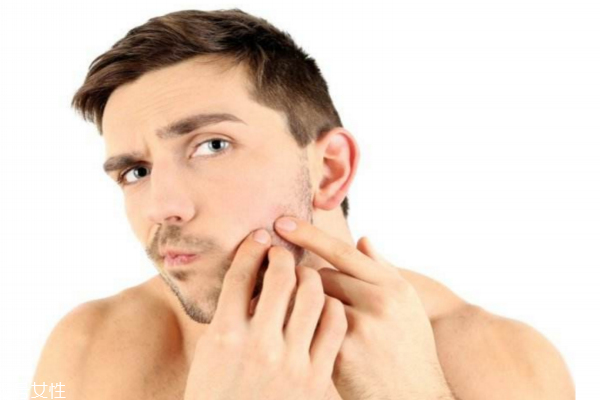 男士雀斑可以彻底祛除吗,男士祛雀斑小妙招