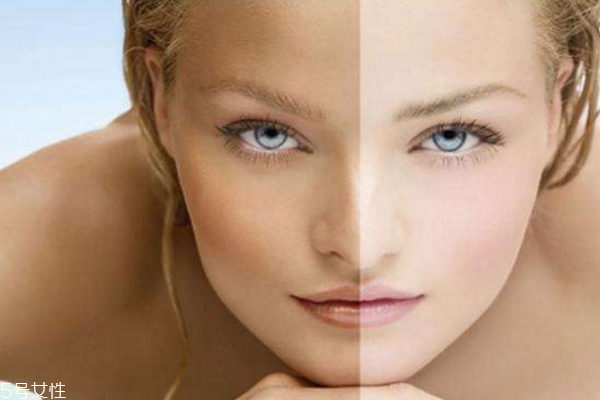 如何祛斑美白更有效,怎么美白祛斑效果最好