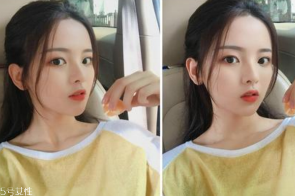 嘴边反复长痘什么原因,嘴巴长痘痘是什么原因引起的