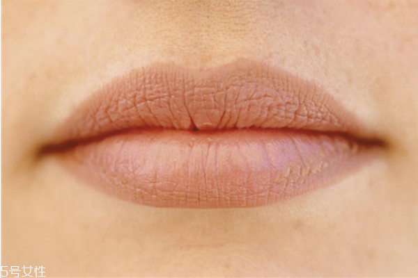 唇纹深是什么原因,该怎么改善,嘴上唇纹特别深怎么回事