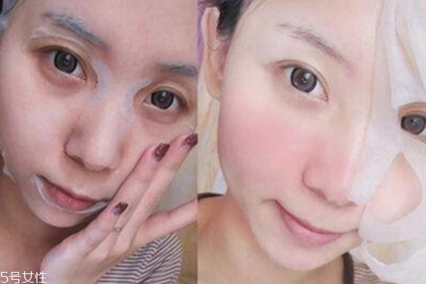 为什么敷完面膜后会冒痘,面膜敷多了会长痘痘吗