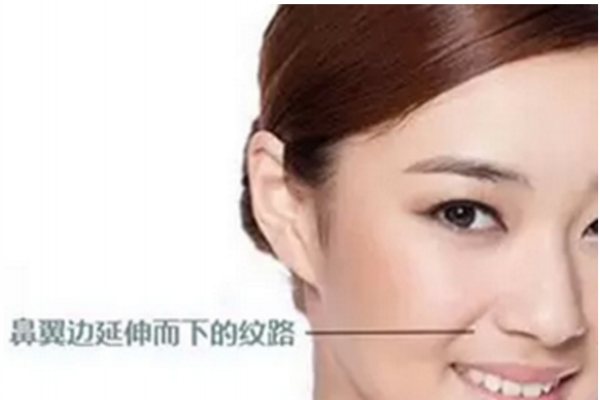 法令纹在什么位置图片,法令纹是什么部位 法令纹在什么位置图片,法令纹是什么部位