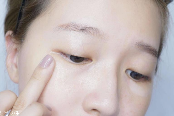 熊猫眼怎么快速消除,眼睛打成熊猫眼怎样恢复快