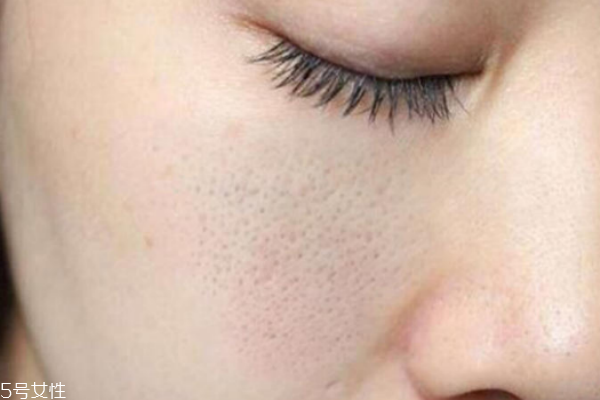 毛孔粗大用什么精华液好,收缩毛孔的精华液排行