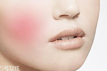 什么面膜适合敏感肌肤使用,脸部比较敏感的用什么面膜好