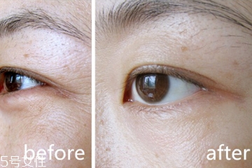 什么成分的眼霜去皱好,能真正有效去皱的眼霜 什么成分的眼霜去皱好,能真正有效去皱的眼霜