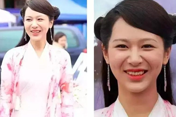 为什么法令纹会突然很明显,最近法令纹特别明显什么原因