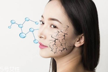 身体皮肤干燥用什么精油,皮肤干燥用什么精油 身体皮肤干燥用什么精油,皮肤干燥用什么精油