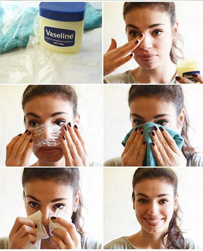 如何用凡士林去黑头,凡士林去黑头方法