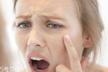 熬夜怎么才能不长痘,怎样防止熬夜长痘痘 熬夜怎么才能不长痘,怎样防止熬夜长痘痘