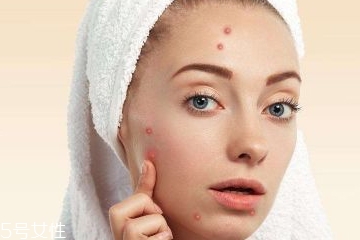 脸颊两侧痤疮怎么治疗,脸颊两侧长痤疮怎么办