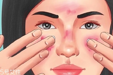 凡士林可以治痘痘吗,凡士林可以去痘痘吗 凡士林可以治痘痘吗,凡士林可以去痘痘吗