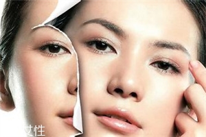 怎样防止皱纹,怎样减少皱纹方法