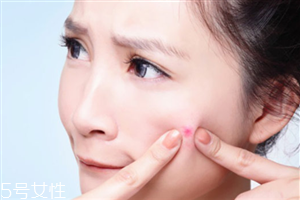 素颜霜v7闷痘吗,v7素颜霜有激素吗