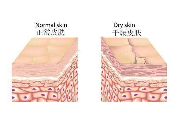 干性皮肤怎么补水,干皮用什么护肤品补水效果好