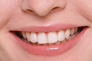 洗牙粉能洗白牙齿吗,牙粉真的能洗白牙齿吗