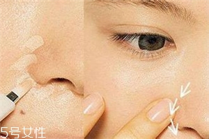 鼻子两边红血丝怎么回事,鼻子旁边有红血丝是什么原因 鼻子两边红血丝怎么回事,鼻子旁边有红血丝是什么原因