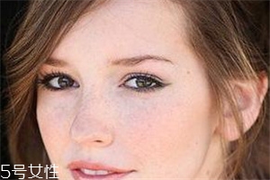 脸上长斑的原因是怎么引起的,女士脸上长斑是什么原因引起