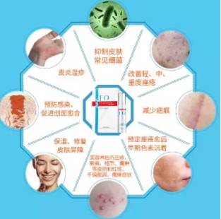 芙清凝胶的功效和作用,芙清凝胶效果好吗