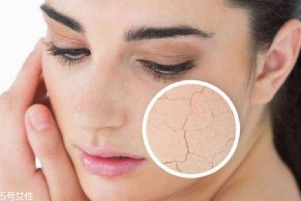 护肤水用了脸上刺痛怎么回事?这3点是关键,护肤水用了脸上刺痛怎么回事?