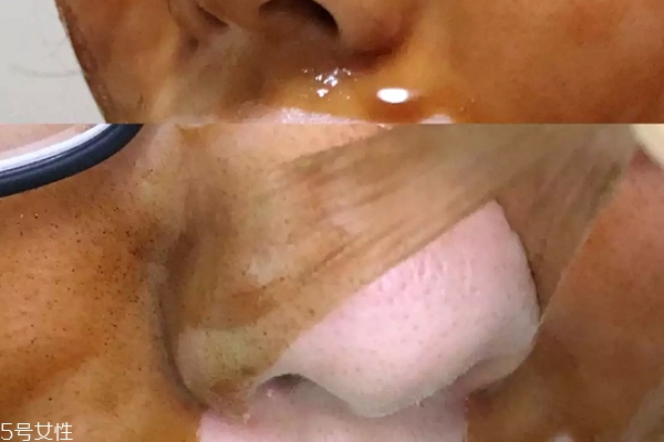 雪花秀撕拉面膜上的黑点,雪花秀撕拉面膜有黑色颗粒吗