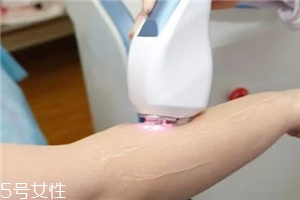 脱毛仪可以脱发际线吗?,脱毛仪能脱发际线吗 脱毛仪可以脱发际线吗?,脱毛仪能脱发际线吗