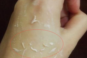 去角质凝露多久用一次比较好,嫩肤去角质凝露多少时间用一次?