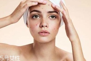 痘痘反复长是什么原因怎么治疗,痘痘反复长是什么原因