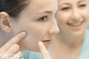 光敏性食物会使皮肤变黑吗,光敏反应会变黑吗