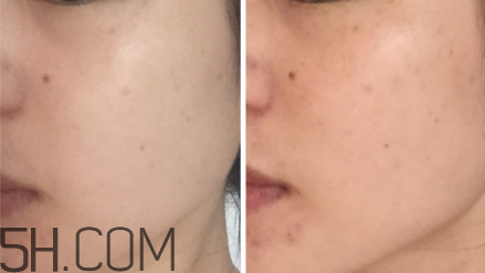 科颜氏淡斑精华有效吗,科颜氏淡斑精华液效果怎么样