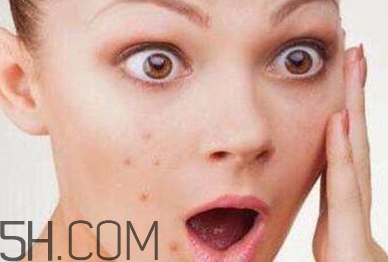 油痘皮肤用什么卸妆好,痘痘肌用卸妆油好吗 油痘皮肤用什么卸妆好,痘痘肌用卸妆油好吗