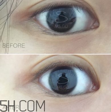 viicode眼膜有用吗,viicode眼膜真有效吗