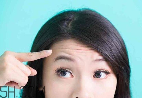 针灸能治抬头纹吗,针灸治疗抬头纹