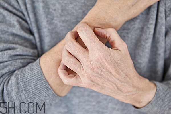 冬天皮肤干燥像蛇皮一样怎么办,皮肤干燥像蛇皮是什么原因 冬天皮肤干燥像蛇皮一样怎么办,皮肤干燥像蛇皮是什么原因