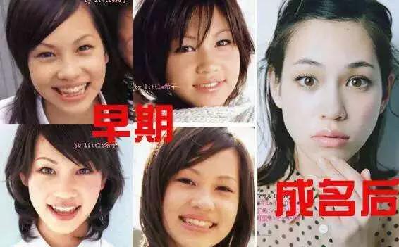 日本整容和韩国整容的区别,韩国整容好还是日本整容好