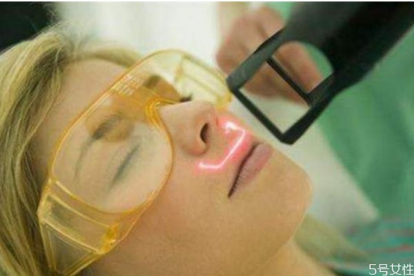 用激光去痣后需要注意些什么,激光去痣后要注意什么事项