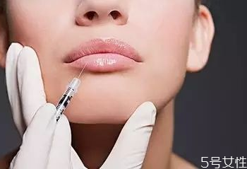 玻尿酸丰唇后可以抽烟吗,丰唇后可以抽烟吗