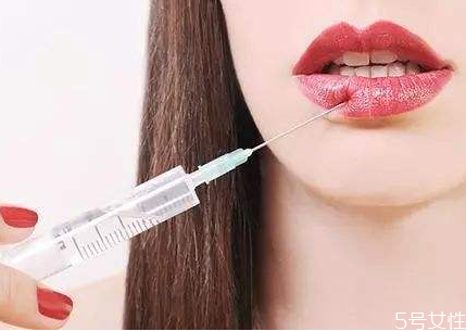 玻尿酸丰唇后可以接吻吗,丰唇多久可以接吻