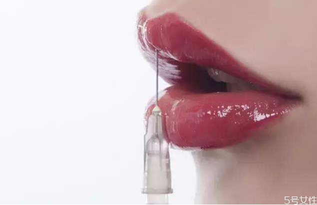 嘴唇打玻尿酸好不好,嘴唇能打玻尿酸吗 嘴唇打玻尿酸好不好,嘴唇能打玻尿酸吗