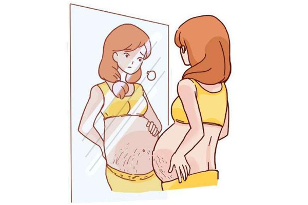 微针祛妊娠纹有效果吗,微针去妊娠纹效果怎么样