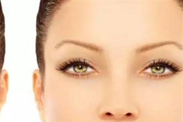 韩式去眼袋多少钱,韩式无痕去眼袋副作用 韩式去眼袋多少钱,韩式无痕去眼袋副作用