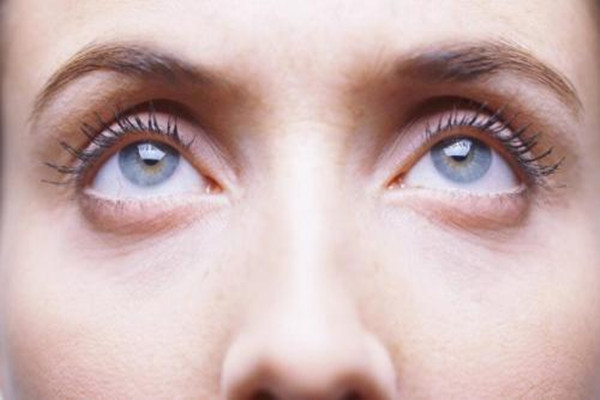 眼袋出现的原因怎么消除,眼袋是因为什么形成的