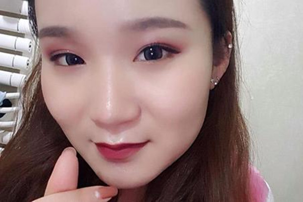 压双眼皮要费用,压线双眼皮价格