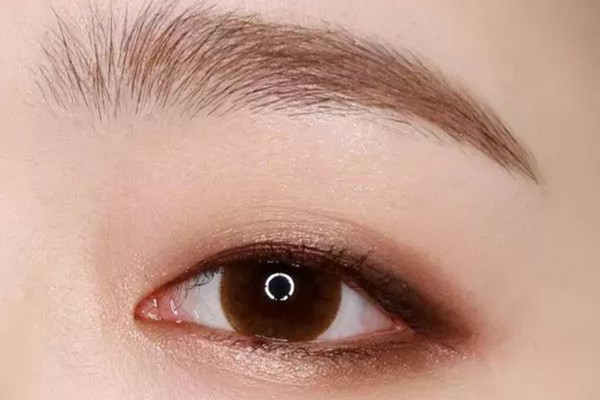 双眼皮修复是什么意思,什么是双眼皮修复手术过程