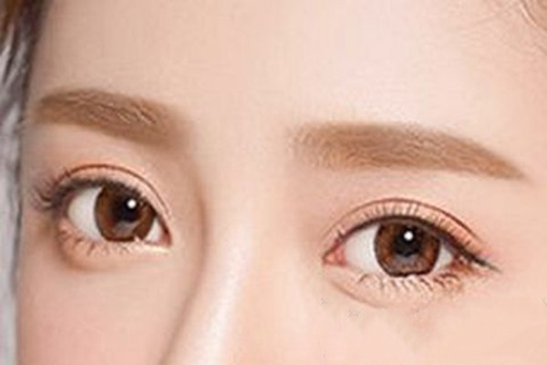 双眼皮吸脂过程,面部吸脂原理