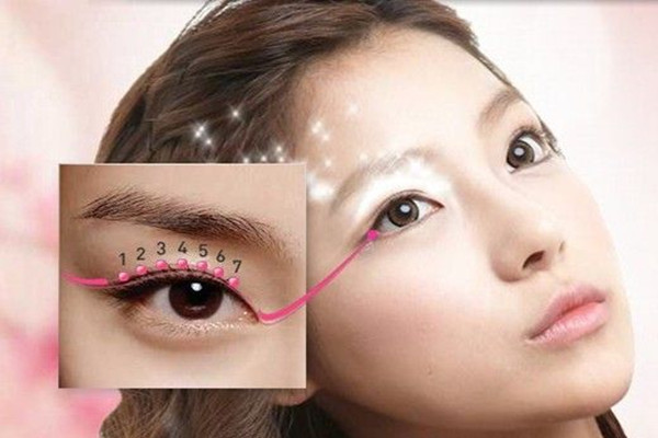 吸雕双眼皮哪里有,新型吸雕双眼皮手术费用