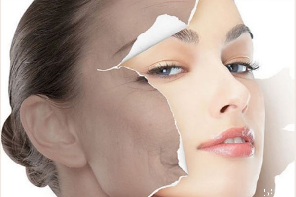 光子嫩肤后一定要用医用面膜吗,光子嫩肤后必须敷医美面膜吗